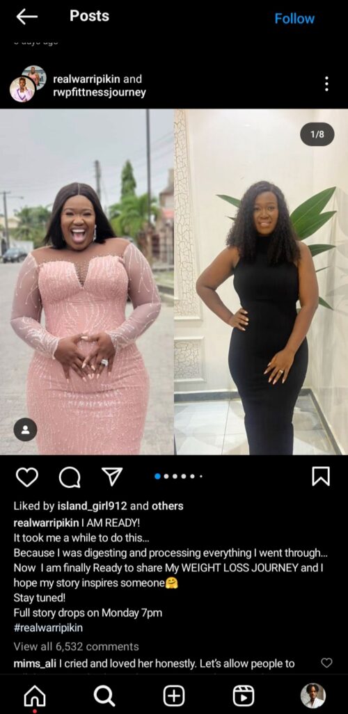 Real Warri Pikin shares her post surgery pictures 